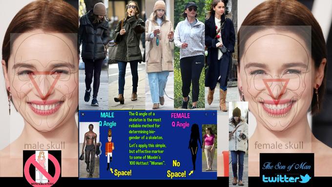 male skull 2 MINCEBUSTERS X MALE QAngle The Q angle of a skeleton is the most reliable method for determining bio- gender of a skeleton. Let's apply this simple, but effective marker to some of Maxim's 100 Hottest "Women". No *Space! FEMALE Q Angle Fellin Space! \/ female skull The Son of Man teonorated by Hont teonorator.com twitter